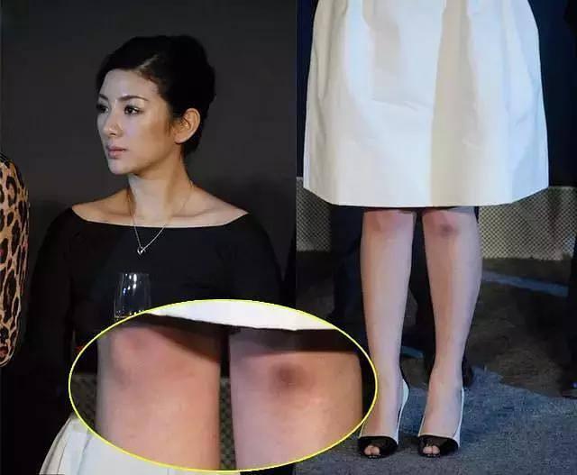 八公举:唐嫣没膝盖,贝嫂少块肉,明星P图走火入魔也是没救了!