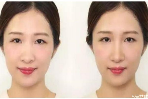  İ취