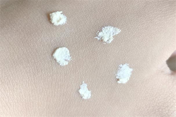 չ󸾸ʺʲô չ󸾸ʺƤ