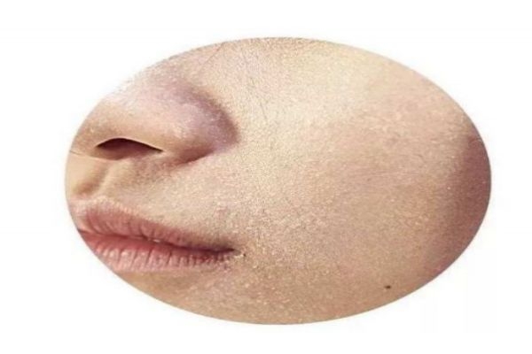 ƤӦô ʺϸƤĻƷʲô