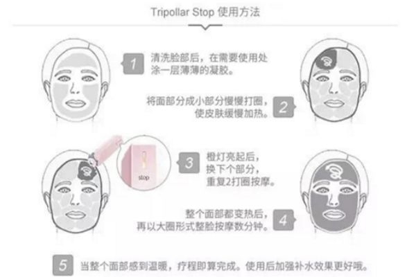 tripollar stop tripollar stopʹʱע