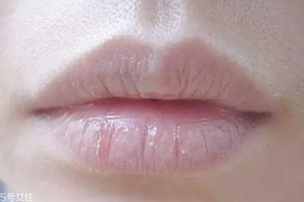 촽Ϊʲô 촽ô