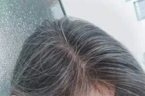 ͷƵйϵ ͷ黹