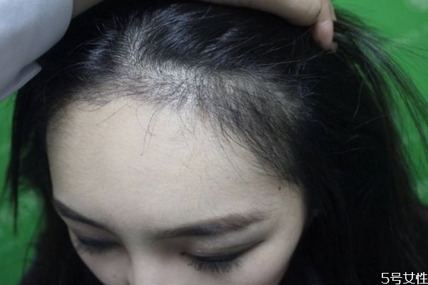 ݰ޷ η