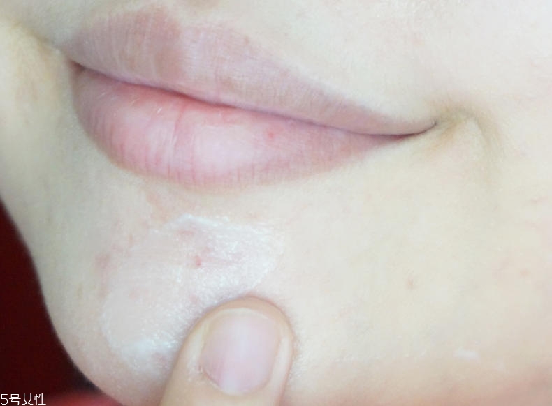 proactive ܽЧ